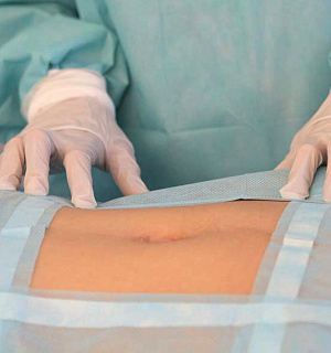 Комплект белья одноразовый общехирургический КООП-02 ГЕКСА стерильный, 6 предметов